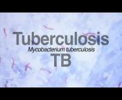 Global Tuberculosis Institute