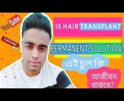 Rayhan Hair Transplant Bangladesh