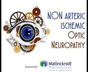 The Optic Neuritis Foundation, Inc.