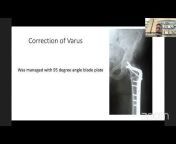 Ortho TV : Orthopaedic Video Channel