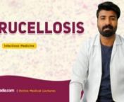 Brucellosis is an Infectioncaused by bacteria and is categorized as one of the Bacterial Human Diseases. Learn about Brucellosis in detail in this online Infectious Medicine Lecture which explains brucellosis etiology, Immunityand pathophysiology of brucellosis along with its clinical features. More in this V-Learning™ is the diagnosis and treatment as well as the difference between brucellosis and Tuberculosis.nn-------------------------------------------------------------nWatch complete