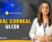 Viral corneal ulcer is the extension of the sqadia.com medical video lecture of Corneal Diseases made from Ophthalmology textbook for medical students. In this V-Learning™, herpes simplex keratitis causes are explained along with ocular herpes simplex lesions and metaherpetic keratitis. The next subject of discussion is herpes zoster ophthalmicus and acanthamoeba keratitis.nn-------------------------------------------------------------nWatch complete lecture on sqadia.com:nhttps://www.sqadia.c