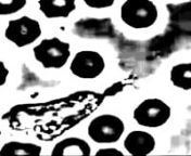 My &#39;ode&#39; to German abstract film.Main character is a leukocyte.Digital manipulation of archive and original footage filmed by Chris Mason.nnMusic: voices 2004 by Ren Van Hirk.nnspinninggoat.net