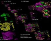 Chromosomes (green, mCherry-H2B), mitochondria (yellow, mitotracker – deep red), and endoplasmic reticulum ( magenta, mEmerald-calnexin) in a field of dividing LLC-PK1 cells (cf., Fig. 4B).Left: individual volume renderings.Center: three-color overlay, with the imaging volume sliced in ∼2 μm thick slabs to facilitate the visualization of the internal arrangement of the features.Right: magnified view of one such slab, showing mitochondrial fragments nestled in ER cisternae.nnCredit: Be