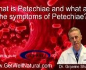 What is Petechiae and what are the Symptoms of Petechiae?nnhttp://www.getwellnatural.com/Idiopathic-Thrombocytopenic-Purpura-ITP.aspxnClick the link above to learn more about Petechiae and other blood platelet disorders.nnIn 2010, Dr. Graeme Shaw MD, integrative medicine specialist, was asked in this video interview:nnWhat is Petechiae and what are the symptoms of Petechiae?nnDr. Shaw responded: nnPetechiae refer to red or purple spots on the body caused by minor hemorrhages in the layers of the