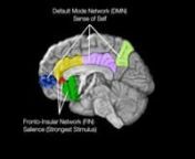 The Default Mode Network (DMN) consists of several different separate regions of the brain. The DMN is a resting state network and is most active when the person is relaxed, awake and not task oriented. It is considered a network responsible for introspection, creativity and self-identity. The Fronto-Insular Network (FIN) is another resting network that is involved in salience, the ability to prioritize stimuli. The FIN salience network focuses the brain on what it determines is most important.