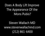 Does A Body Lift Improve The Appearance of the Mons Pubis - Steven G. Wallach, MD from pubis
