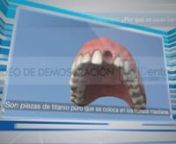 DentalTEL video demo 5min from 5min