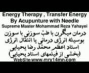 درمان میگرن با طبّ سوزنی با سوزن بوسیله انرژی درمانی یا انتقال انرژی.nnSupreme Master