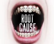 Root Cause is a feature length documentary based on one man’s extraordinary true story – a 10 year long journey to find the root cause of his panic attacks, anxiety, chronic fatigue, nausea, dizziness, agitation and insomnia. Interviews with expert health professionals from all over the world provide incredible insights into how an infected root canal can effect other health functions of the body. Featuring leaders in their fields like Dr. Mercola, Dr. Dawn Ewing and Dr. Jerry Tennant; the w
