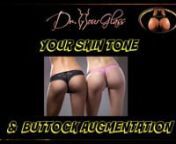 It is very interesting that almost no surgeon talk about how the tightness of your buttock ultimately will determine the projection that you are going to have.Sure you have gone online, read about buttock augmentation, stories about how much fat was injected in the buttock, how big the buttock got, but ultimately the first and foremost important concept that you need to understand is that buttock augmentation depends on your skin tone.So let us talk about the skin tone.Different women or m