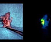 Video 1. Postmortem resection in a xenografted mouse using MFGS. A xenografted animal was injected with bevacizumab-IRDye800CW and imaged 72 hours later with the SurgVision intraoperative fluorescence camera system. This video shows the white-light resection on the left side and the fluorescence guidance on the right side. Throughout resection, the tumor can be distinguished using both white-light and fluorescence imaging. © University Medical Center Groningen, published with permission.nnhttps
