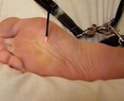 Bound foot subjected to bastinado, hot incense stick and other cruel tortures...