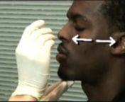 A video by the U.S. Department of Health and Human Services and the Center for Disease Control demonstrates the proper collection of a nasopharyngeal swab clinical specimen for Bordetella pertussis testing.nnThe views and opinions expressed in these videos are those of the authors and do not necessarily reflect COPAN&#39;s official policy, recommendation or position. Always read the manufacturer’s package insert for specific instructions regarding specimen collection and transport for the type of