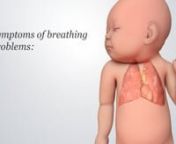 Newborns that struggle to breathe shortly after birth may have a breathing condition. Symptoms of newborn breathing conditions usually happen at birth or within the first few hours that follow. After the baby is born, a provider will watch them closely for any symptoms of a breathing disorder, such as irregular breathing, grunting, or a bluish tint to the baby’s skin. nnIf your baby has any of these symptoms, providers must act quickly to find out what is wrong and begin treatment to help them
