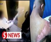 A 33-year-old Down Syndrome man was splashed with hot water by a woman in a lift at an apartment in Bayan Lepas, Penang on Friday (April 19).&#60;br/&#62;&#60;br/&#62;Police have detained a 39-year-old suspect, who lives in the same apartment as the victim.&#60;br/&#62;&#60;br/&#62;Read more at https://tinyurl.com/45enrsa8&#60;br/&#62;&#60;br/&#62;WATCH MORE: https://thestartv.com/c/news&#60;br/&#62;SUBSCRIBE: https://cutt.ly/TheStar&#60;br/&#62;LIKE: https://fb.com/TheStarOnline