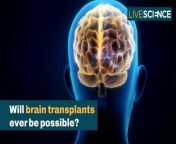 Brain transplants are a long way from being feasible, and even if the technical challenges could be overcome, there are ethical issues to grapple with.