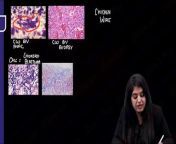 Bone and soft tissue \ \pathology from tissue le lo ful video